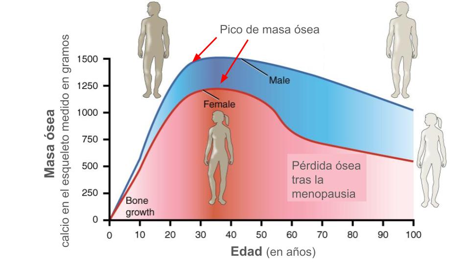 Aumento de osteoporsis con el paso de los años