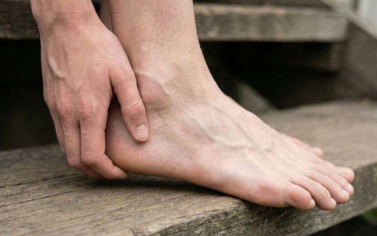 Dolor en el talón por enfermedad de Sever (apofisitis del calcáneo)