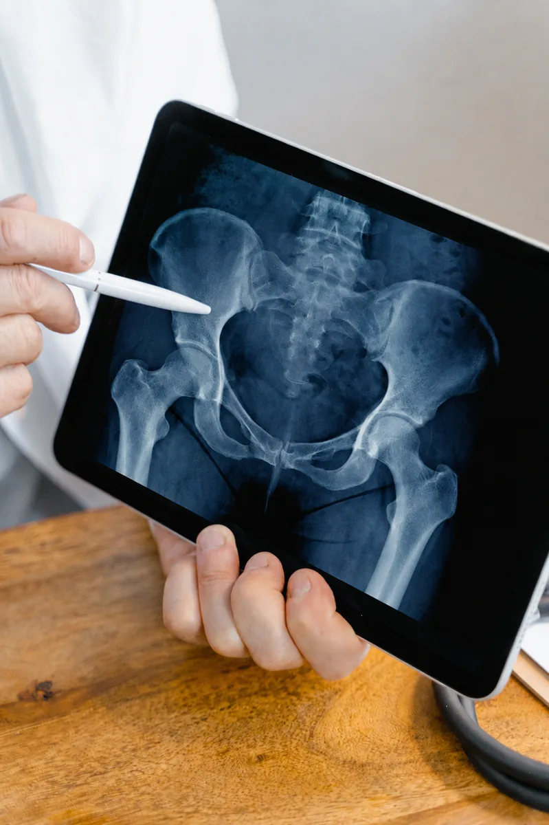 Radiografía de pelvis y caderas revisada en consulta